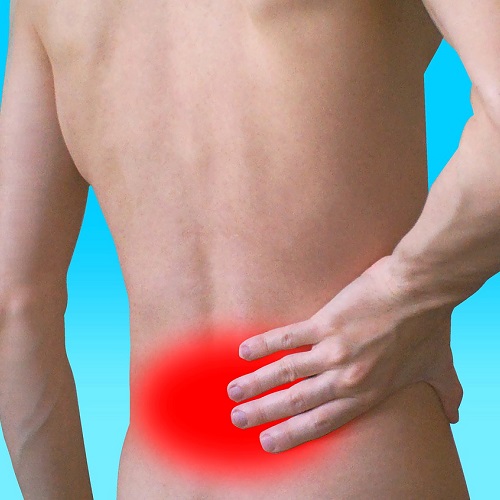 figurative image of man with lower back pain in need of sciatica relief