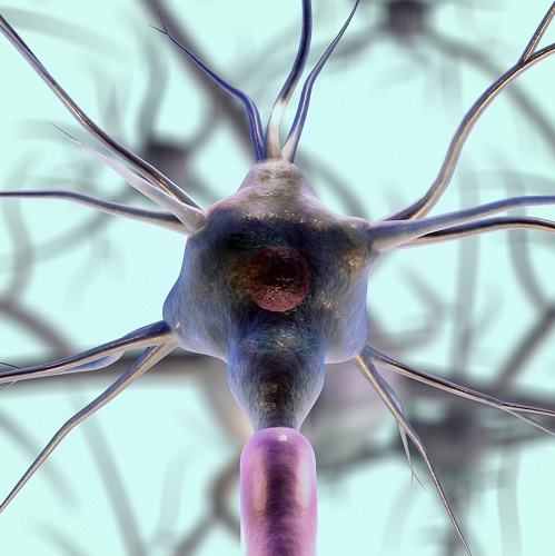 nerve cell affected by motor neurone disease